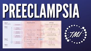 Preeclampsia Explicada Claramente [upl. by Neerihs]