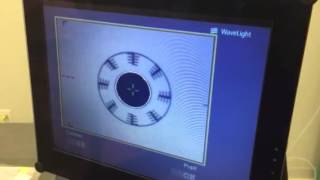 Alcon Allegretto Eye Q 400Hz Excimer Laser System Eye Tracker Test [upl. by Iinden997]