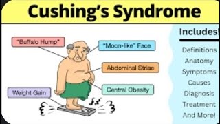 Cushing Syndrome Also Called Hypercortisolism  Signs and Symptoms cushingsyndrom [upl. by Necyrb]