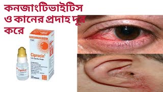 সিপ্রোসিন ড্রপের কাজ কি।Ciprocin eye drop। [upl. by Leciram]