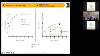 COPD  Understanding The New Gold Guidelines with Dr Daniel Ray  February 09 2023 [upl. by Nimsay723]