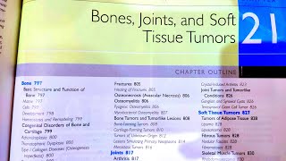 Bone Joints and Soft tissue tummors chapter Robbins pathologyComposition of BoneOsteoclast functin [upl. by Sedinoel]