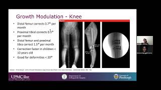 Lower Extremity Deformity [upl. by Etoile229]