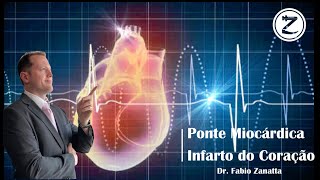 54 Ponte Miocárdica  Isquemia e Infarto do Coração [upl. by Nimrak276]