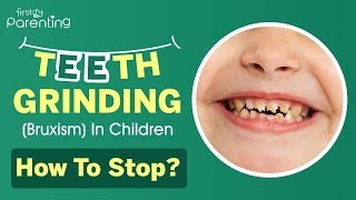 Teeth Grinding Bruxism in Children  Causes Symptoms amp Treatment [upl. by Aekal763]