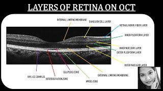 Learn How To Identify Retinal Layers on OCT  Retina  Ophthalmology [upl. by Eilarol]