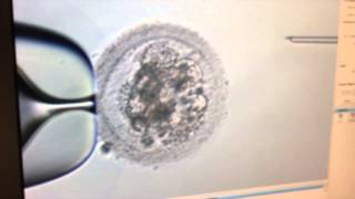 Fécondation in vitro ICSI training [upl. by Horten]