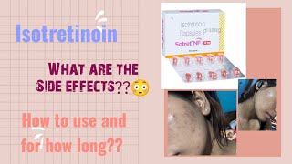 Side effects  Sotret Nf 16mg review acne isotretinoin clearskin clearskinjourney [upl. by Rudyard224]