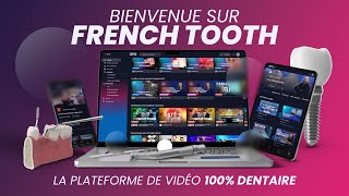 Embarquez dans la plateforme de formation vidéos 100 DENTAIRE 🦷 [upl. by Enitsyrk]