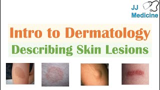 Introduction to Dermatology  The Basics  Describing Skin Lesions Primary amp Secondary Morphology [upl. by Marucci]