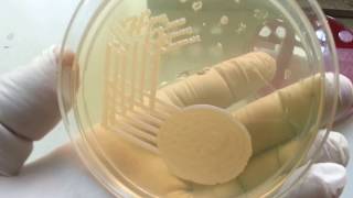 Klebsiella pneumoniae [upl. by Liggett914]