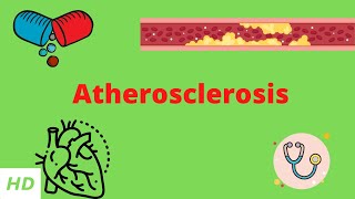 Atherosclerosis Causes Signs and Symptoms Diagnosis and Treatment [upl. by Mohkos]