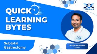 QuickLearningByte  SUBTOTAL GASTRECTOMY  SURGERY  DR RAJAMAHENDRAN  DOCTUTORIALS [upl. by Savart]