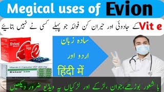 Evion 400mg for skin kese use karen  evion 400 khane ke fayde benefits and uses vitamin e capsule [upl. by Yenaled975]