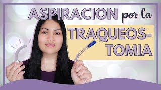 Aspiración por la Traqueostomía [upl. by Erl]