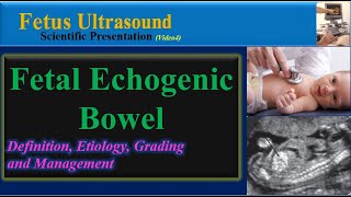 Fetus Ultrasound  Fetal Echogenic Bowel [upl. by Aremahs]