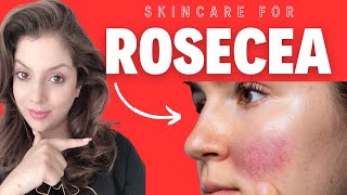 New Skincare Routine For Rosacea And Sensitive Skin [upl. by Alfredo]