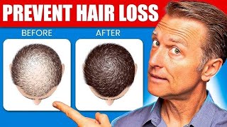 6 Proven Remedies to Prevent Hair Loss and Regrow Hair ameerht hairlosstreatment hairfall [upl. by Yeliah681]