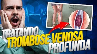 Como tratar uma Trombose Venosa Profunda [upl. by Aisauqal926]