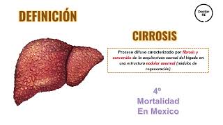 CIRROSIS Y COMPLICACIONES  ENARM  MEDICINA INTERNA [upl. by Boehike391]