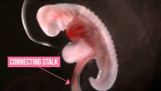 EMBRYO  LEECH AMAZING QURAN MIRACLE MINDBLOWING [upl. by Reeva216]