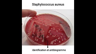 Staphylococcus aureus  Identification et antibiogramme [upl. by Wystand799]