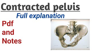 Contracted pelvis causes  symptoms and management [upl. by Artemla410]