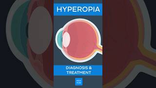 Hyperopia Diagnosis amp treatment  Kenhub hyperopia [upl. by Eladnor332]