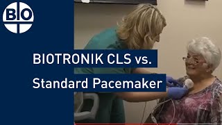 Comparing Heart Rate Regulation BIOTRONIK CLS vs Standard Pacemaker [upl. by Nospmis]