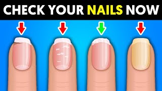 Warning 8 Things Your Nails Tell You About Your Health [upl. by Johannes837]