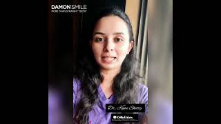 Dr Kimi Shetty shared her lifechanging journey with Damon System  Damon Smile [upl. by Eirrok760]