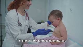 Hematuria in Children  The Differential Diagnosis With Fraterne ZU medicalexcellencecenter [upl. by Claudia]