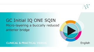 GC Initial IQ ONE SQIN Micro layering a buccally reduced anterior bridge [upl. by Skipper]