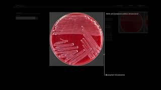 Lipohylic Test  Microbiology [upl. by Cope]