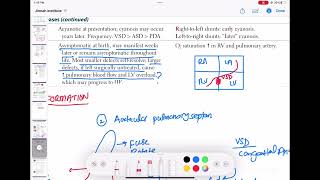 Ventricular septal defect pathophysiology cardiology 60  First Aid USMLE Step 1 in UrduHindi [upl. by Nilatak]