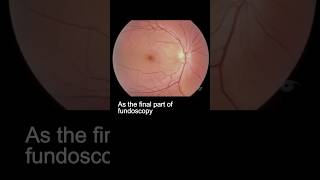 Examining the fundus – part 3 ophthalmology [upl. by Lorrin]