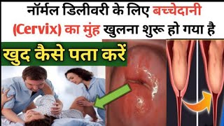 9वे महीने में बच्चेदानी का मुंह खुलने के लक्षण  SYMPTOMS OF CERVIX OPENINGCervix opening symptoms [upl. by Yasdnyl337]