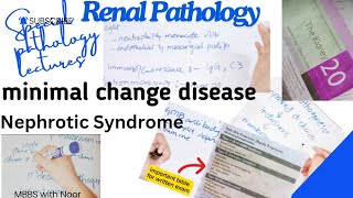 minimal change disease  nephrotic syndrome  renal pathology lectures  selflessmedicose [upl. by Ruthven]