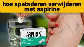 Spataderen verdwenen op de 7e dag neem aspirine en [upl. by Nguyen453]