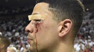 Top 5 Worst Sports Injuries of 2016 [upl. by Yerfdog424]