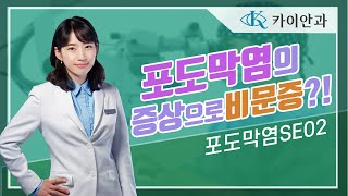 포도막염의 증상으로 비문증  포도막염 증상  비문증  후방포도막염  망막질환  카이안과TV [upl. by Geer153]