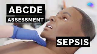 ABCDE Assessment  Sepsis  Emergency Simulation Scenario  OSCE Guide  UKMLA  CPSA [upl. by Laughlin368]