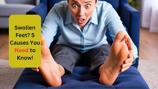 Why Are Your Feet Swelling Top 5 Health Issues to Know [upl. by Sirkin]