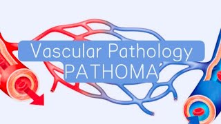 Vascular PATHOMA 5  ArteriolosclerosisMonkeburg sclerosis [upl. by Ardnaxela]