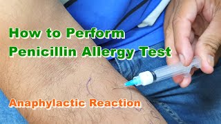 Penicillin G Allergy Test  Benzylpenicillin  Type 1 Hypersensitivity Reaction  How to Do [upl. by Ruenhs]