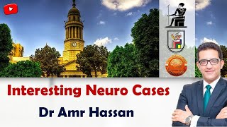 Interesting Neuro Casesأدعمرو حسن الحسني أستاذ المخ و الاعصاب [upl. by Ahtnams]