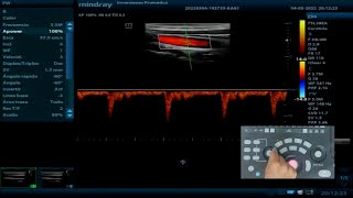 Z50 Mindray  Instalación y Configuración ✅ [upl. by Cindelyn]