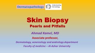 Skin Biopsy Pearls and Pitfalls [upl. by Einej]