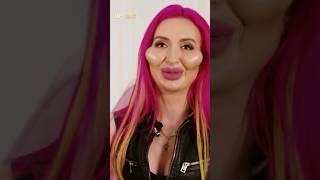 Shocking Celebrity Cosmetic Surgery Disasters celebritynews [upl. by Amorita102]