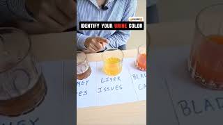 Urine Colour Testlikesharesubscribe [upl. by Davina]